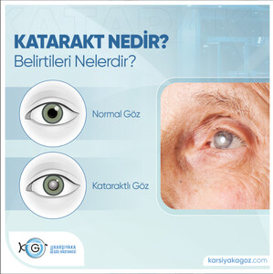 Private Karşıyaka Eye Hospital _1