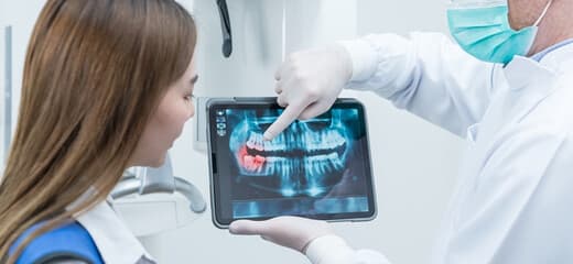 Dental X-Ray Key Diagnostic Tool for Oral Health