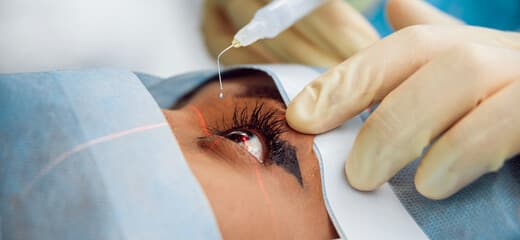 Cataract Surgery: Recovery and How It Works