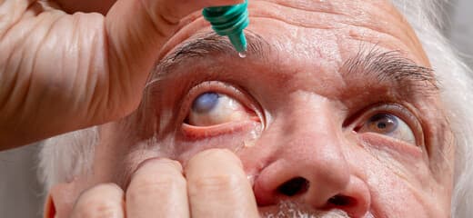 A Comprehensive Guide to Glaucoma Treatment