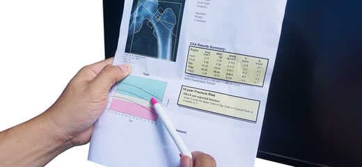 Calcium Score Scan (Cardiology)