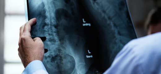 Medical X-Ray (Orthopaedics)
