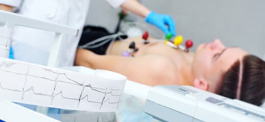 ECG - Electrocardiogram (General Practice)