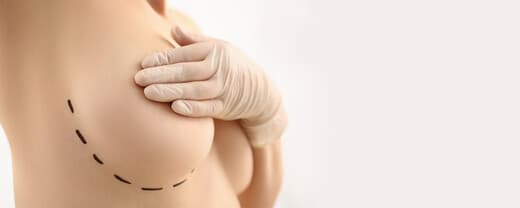 Curiosities about Breast Lift Operation