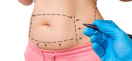 The Ultimate Guide to Tummy Tuck Surgery: Achieve a Slimmer Waistline