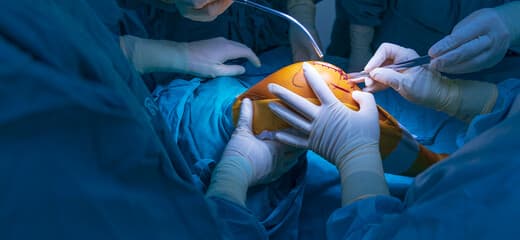 Knee Reconstructive Surgery in Turkey