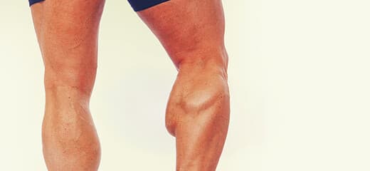 Calf Muscle Reduction
