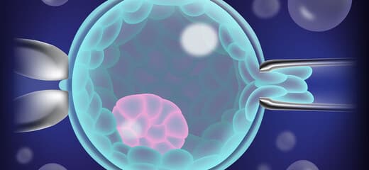 Preimplantation Genetic Diagnosis: Overview, Indications
