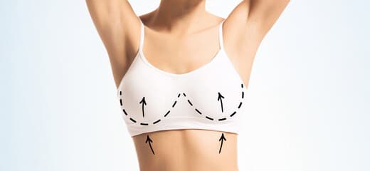 Guide to Breast Lift With Fat Transfer