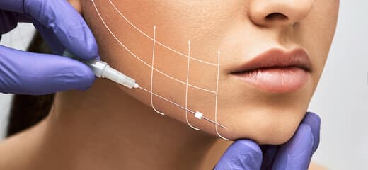Vampire Facelift: Procedure, Cost, Safety, and More