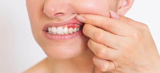 3 Signs You Need to See a Periodontist