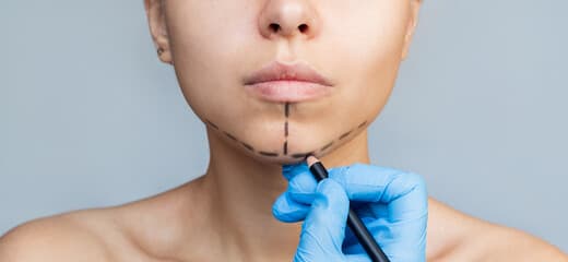 What You Need To Know About Jaw Contouring Surgery
