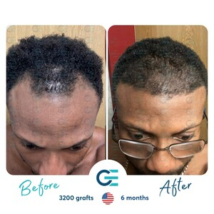 GE Hair Clinic _2