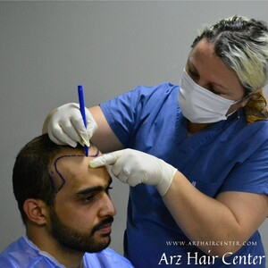 Arz Hair Center Saç Ekim Merkezi _2