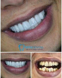 Istadental - Istanbul Dental Aesthetic Clinic _2