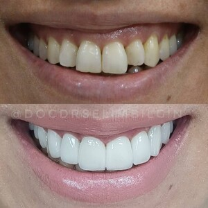 Pro Estetik Dental Clinic - Selim Bilgin _3