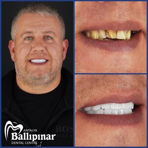 Ballipinar Dental Centre _0