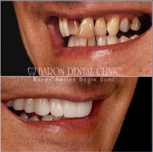 Baron Dental Clinic _1