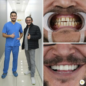 Yesilyurt Dental _2