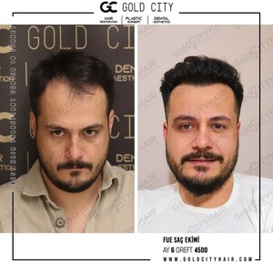 Gold City Hair _3