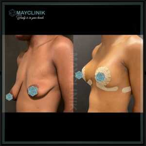 MayClinik Plastic Surgery _3