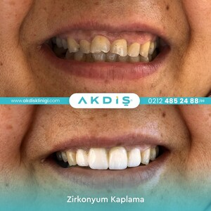 Akdis Clinic _3