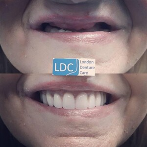 London Denture Care _1