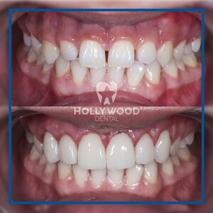 Hollywood Dental Izmir _2