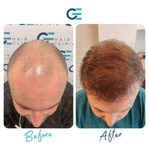 GE Hair Clinic _3