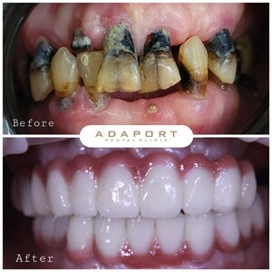 Adaport Dental Clinic _3