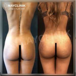 MayClinik Plastic Surgery _2