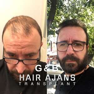 Hair Ajans _1
