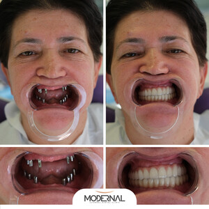 Modernal Dental Clinic _2