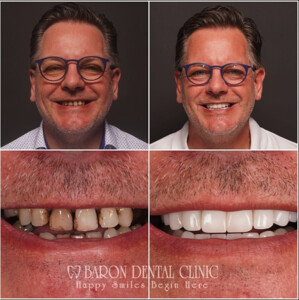 Baron Dental Clinic _2