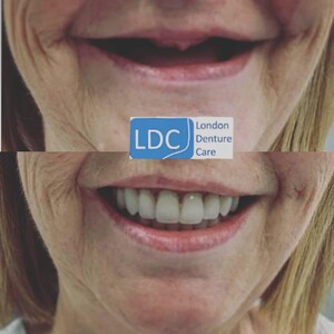 London Denture Care _0