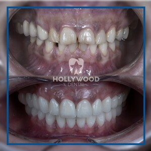 Hollywood Dental Izmir _0