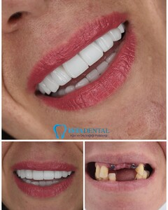 Istadental - Istanbul Dental Aesthetic Clinic _3