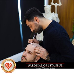 Medical of Istanbul HairTransplant _1