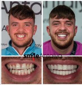 Smile Antalya Dental _0