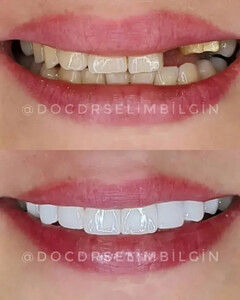 Pro Estetik Dental Clinic - Selim Bilgin _2