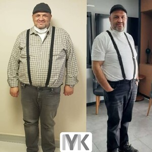 MYK Clinic - Dr. Metin Yüksel Kerimoğlu _3