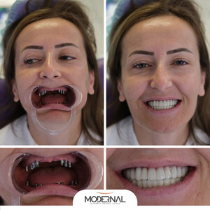 Modernal Dental Clinic _1