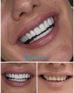 Istadental - Istanbul Dental Aesthetic Clinic _1