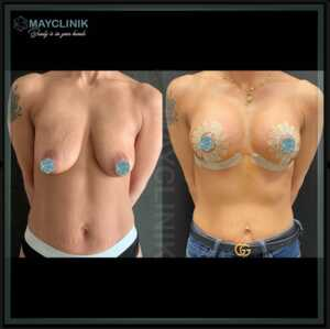 MayClinik Plastic Surgery _1
