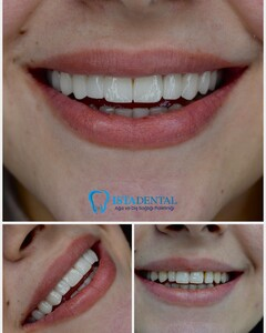 Istadental - Istanbul Dental Aesthetic Clinic _0