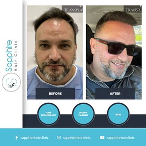 Sapphire Hair Clinic _2