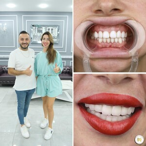 Yesilyurt Dental _0