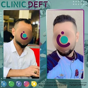 Clinicdeft _0