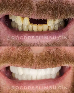 Pro Estetik Dental Clinic - Selim Bilgin _1
